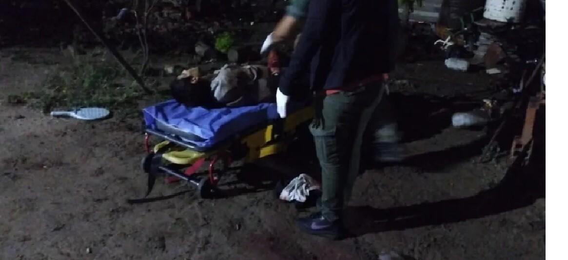Santiago del Estero: un joven  ingresó a una casa a robar y los perros lo dejaron en grave estado
