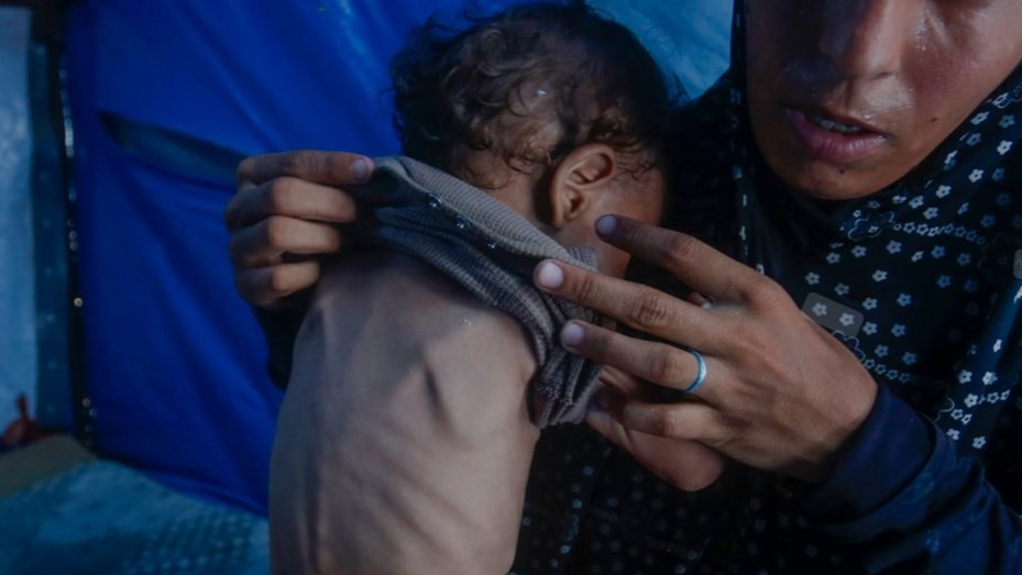04.jpg Gaza: Ya son 227 los muertos relacionados con la desnutrición, afirmó la ONU