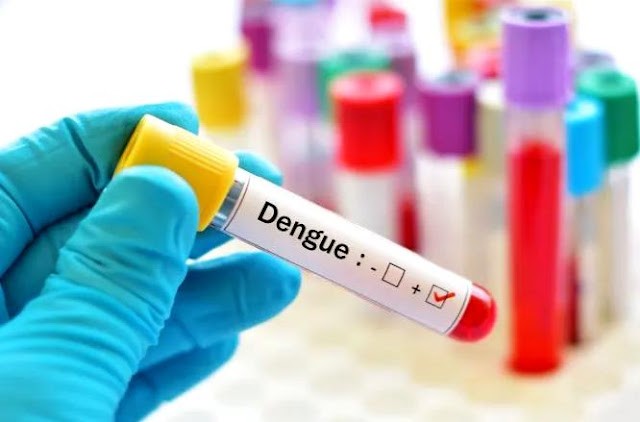 10-1-4-678x381.jpg En esta semana, un nuevo descenso en los casos de dengue fue reportado