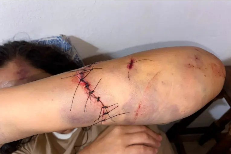 Atacaron con un hacha a una mujer en Santa Ana: hay preocupación por el estado de salud de la víctima