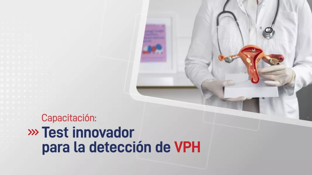 Capacitarán a profesionales de la salud sobre un test innovador para la detección de VPH