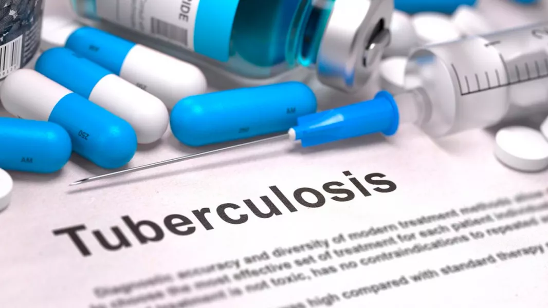 100743-en-el-anio-2024-se-diagnosticaron-967-nuevos-casos-de-tuberculosis-en-salta.webp En el año 2024 se diagnosticaron 967 nuevos casos de tuberculosis en Salta