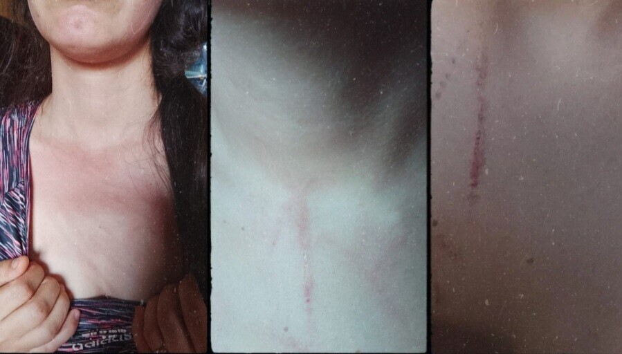 53318.jpg Colonia Delicia: denunciaron brutal agresión a una madre y su hermana frente a un niño de 4 años