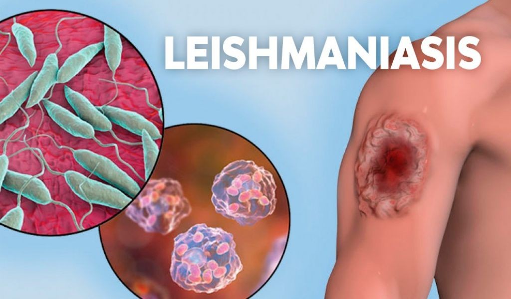Norte de Salta: notificaron 25 casos de leishmaniasis cutánea humana