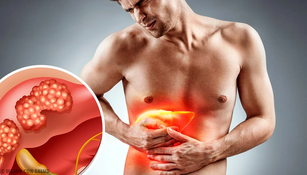 Cáncer-de-hígado-todo-lo-que-debes-saber.webp Cáncer de hígado: la bebida que todos toman y puede dañar el cuerpo