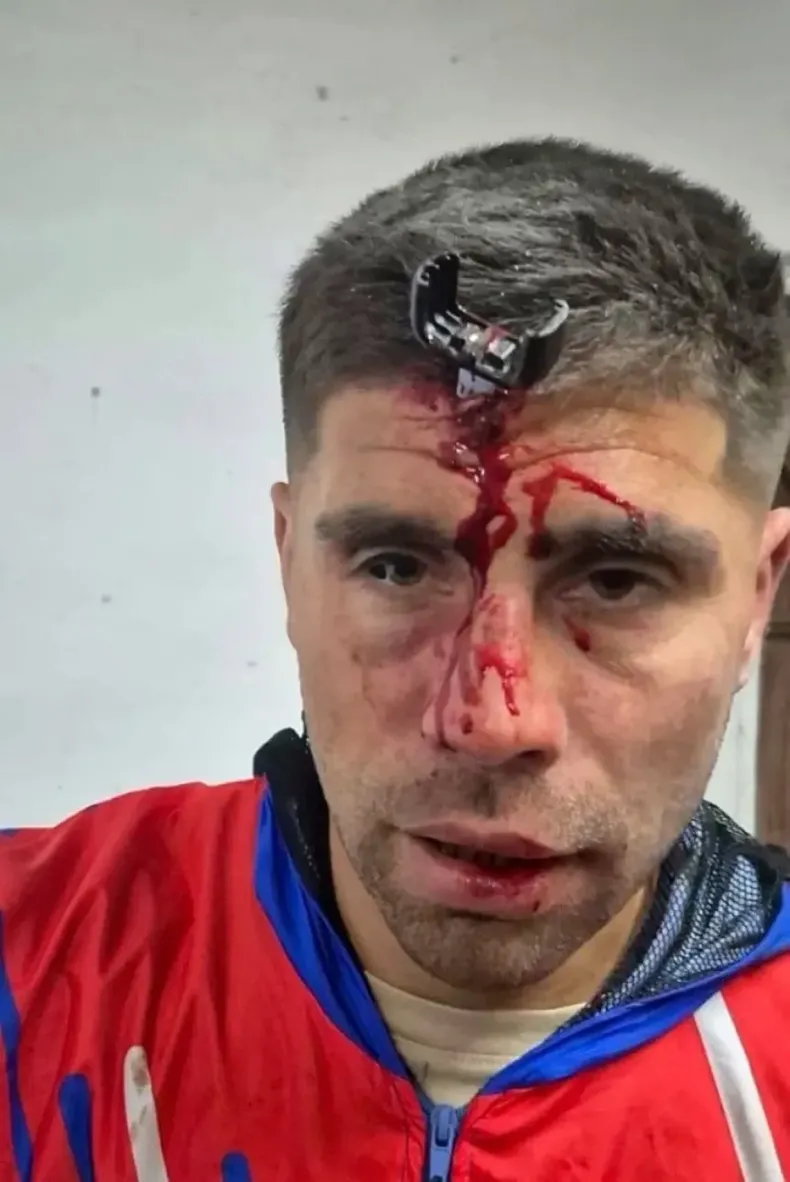 FUTBOLISTA.webp FUTBOL DE ASCENSO :Berazategui Agresión a un jugador del Ascenso: le clavaron una llave en la cabeza