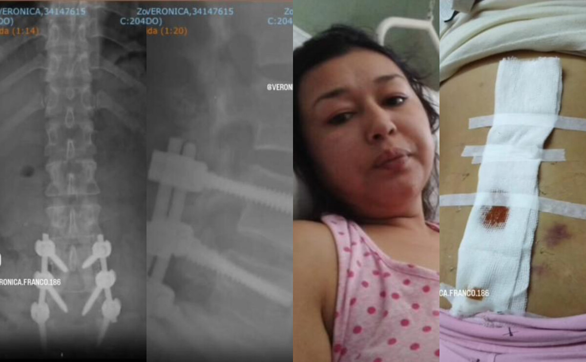 De la lesión al pánico: el vía crucis de Verónica Franco en la fuerza