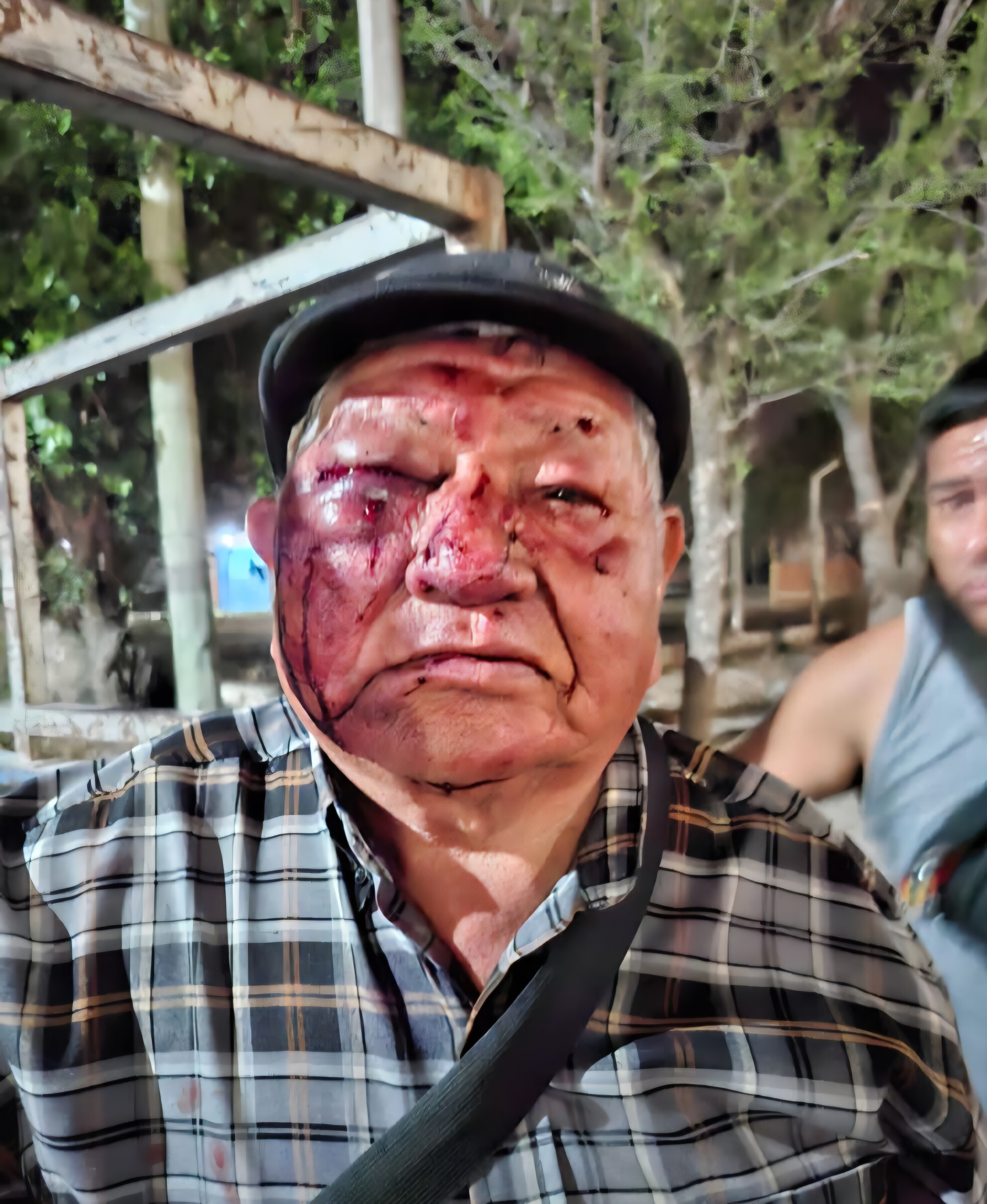 “CREÍA QUE ME MATABA”: GOLPEARON SALVAJEMENTE A UN JUBILADO Y EL ATACANTE QUEDÓ LIBRE