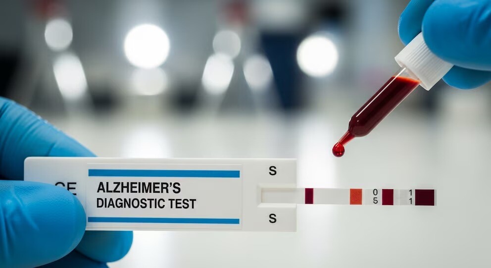 Aprobación histórica en Europa: un test de sangre simplifica el diagnóstico del Alzheimer