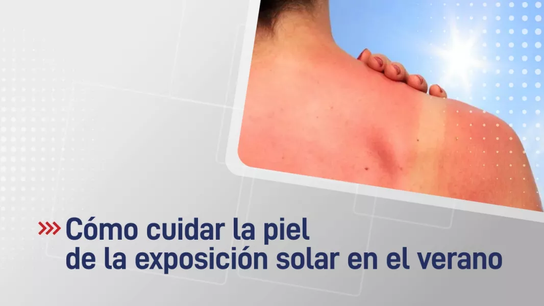 Cómo cuidar la piel de la exposición solar en el verano