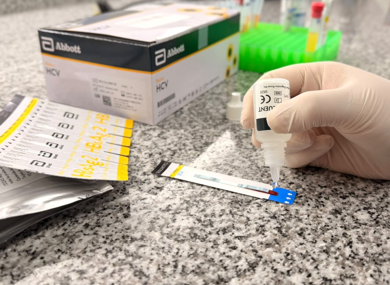 hepatitis-4.jpeg