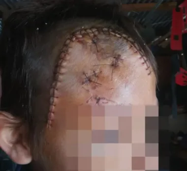 nene.webp Niño atacado en la calle: «Voy a propiciar la carátula de tentativa de homicidio»