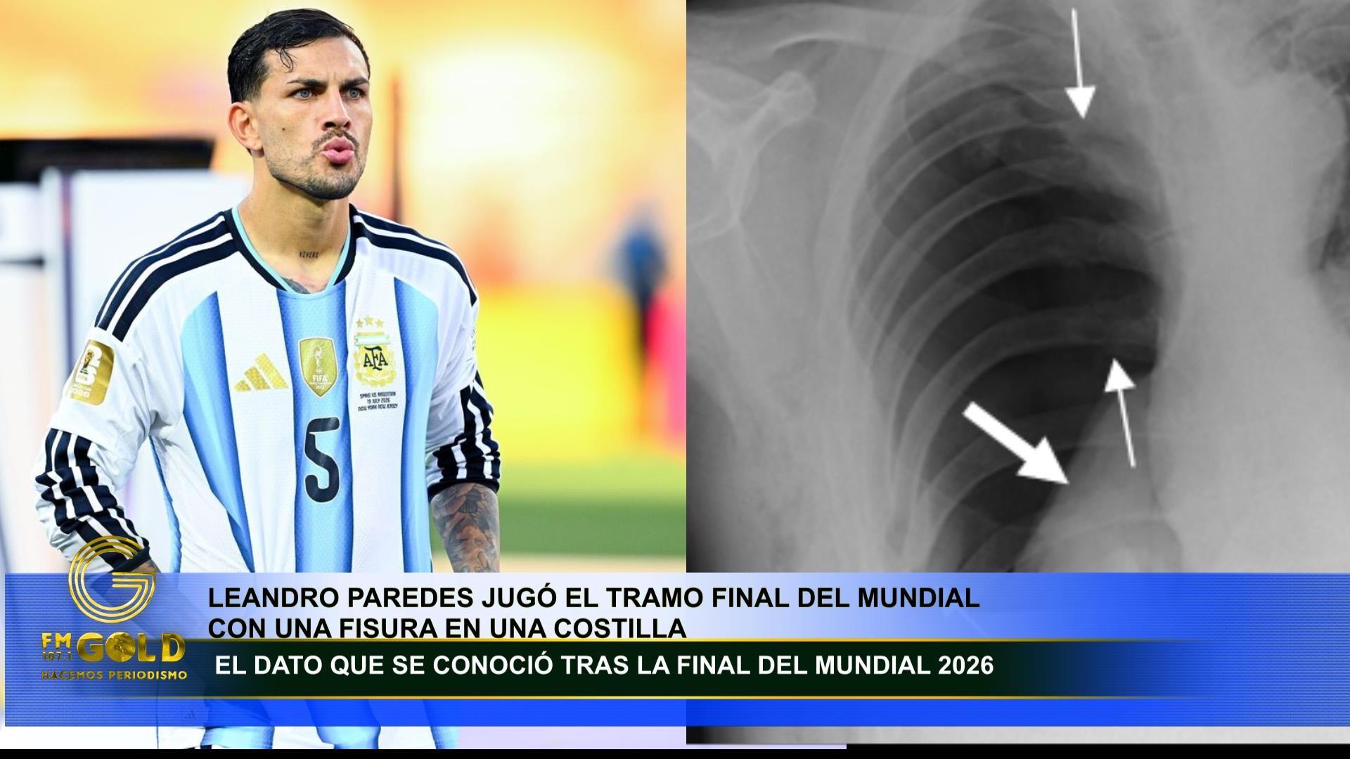 Leandro Paredes jugo casi todo el mundial con una fisura en una costilla
