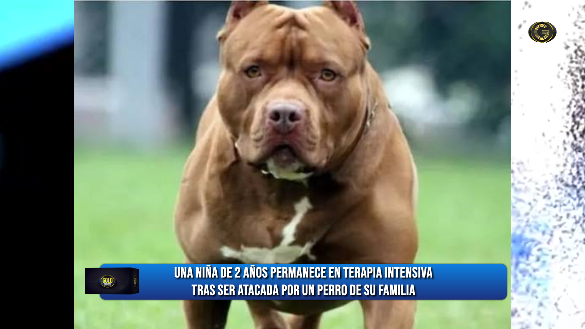 Una niña de 2 años está en terapia intensiva tras ser atacada por el perro de su familia en tucumán
