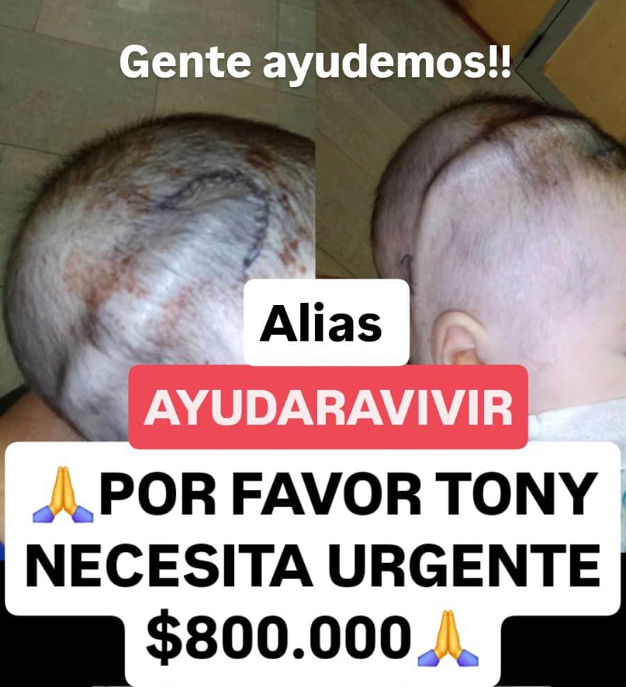 Un bebé de seis meses luchando por vivir
