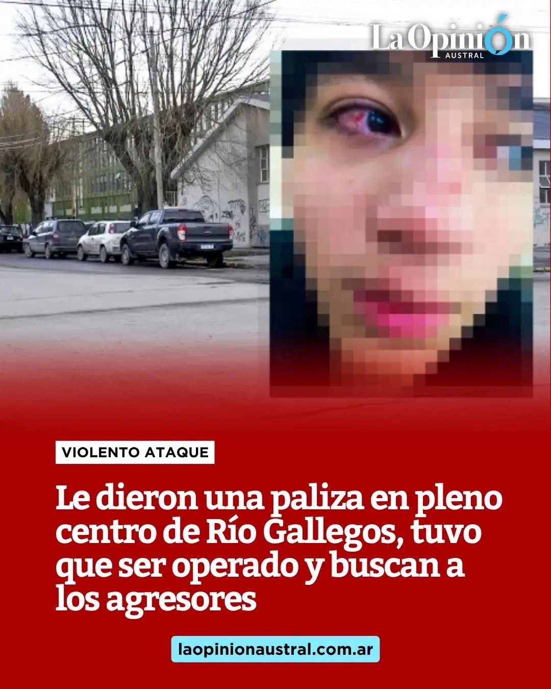 LE DIERON UNA PALIZA EN PLENO CENTRO DE RÍO GALLEGOS, TUVO QUE SER OPERADO Y BUSCAN A LOS AGRESORES LE DIERON UNA PALIZA EN PLENO CENTRO DE RÍO GALLEGOS, TUVO QUE SER OPERADO Y BUSCAN A LOS AGRESORES