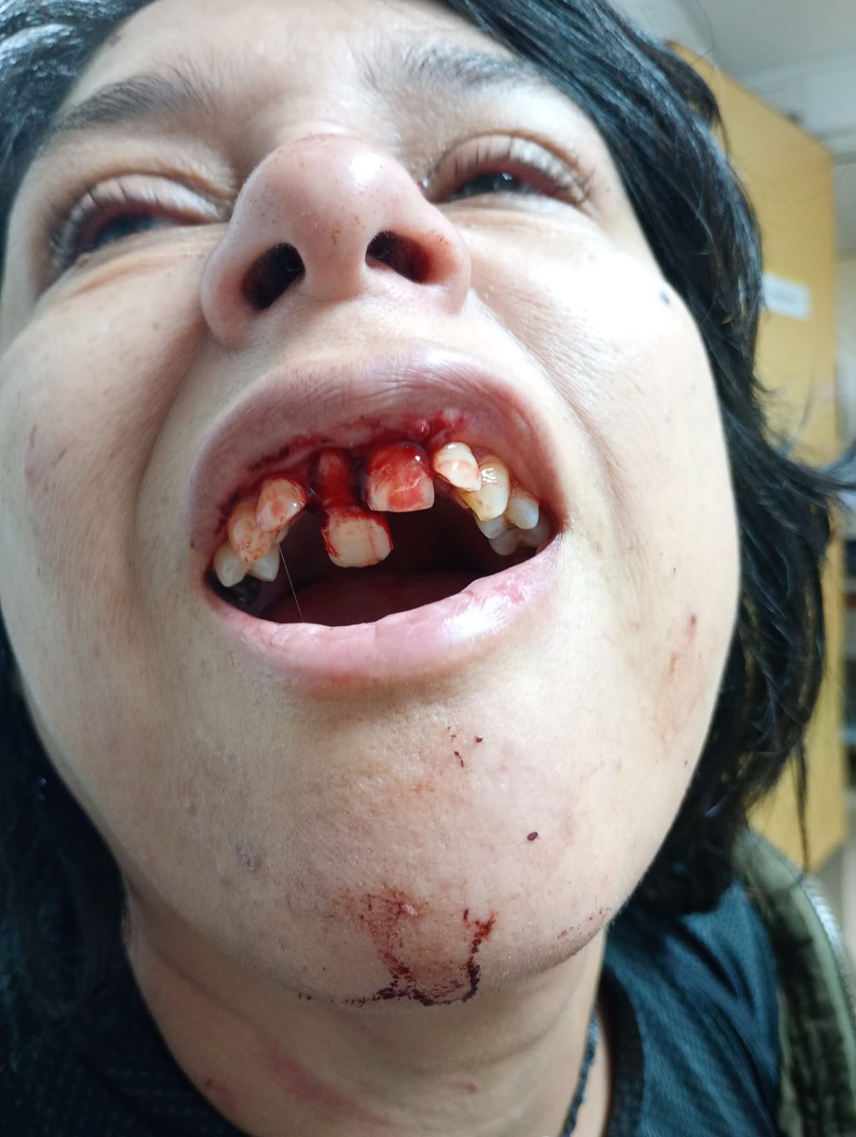 DOMINGO DE TERROR: CANTANTE SUFRE AGRESIÓN DE SU PAREJA 
