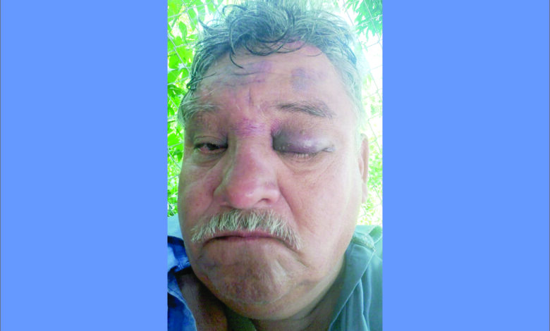 FUERON REMISEROS DE SALTA Y DENUNCIAN QUE YA HABÍAN ATACADO A OTROS REMISEROS EN LA PARADA DE LA TERMINAL DE ORÁN