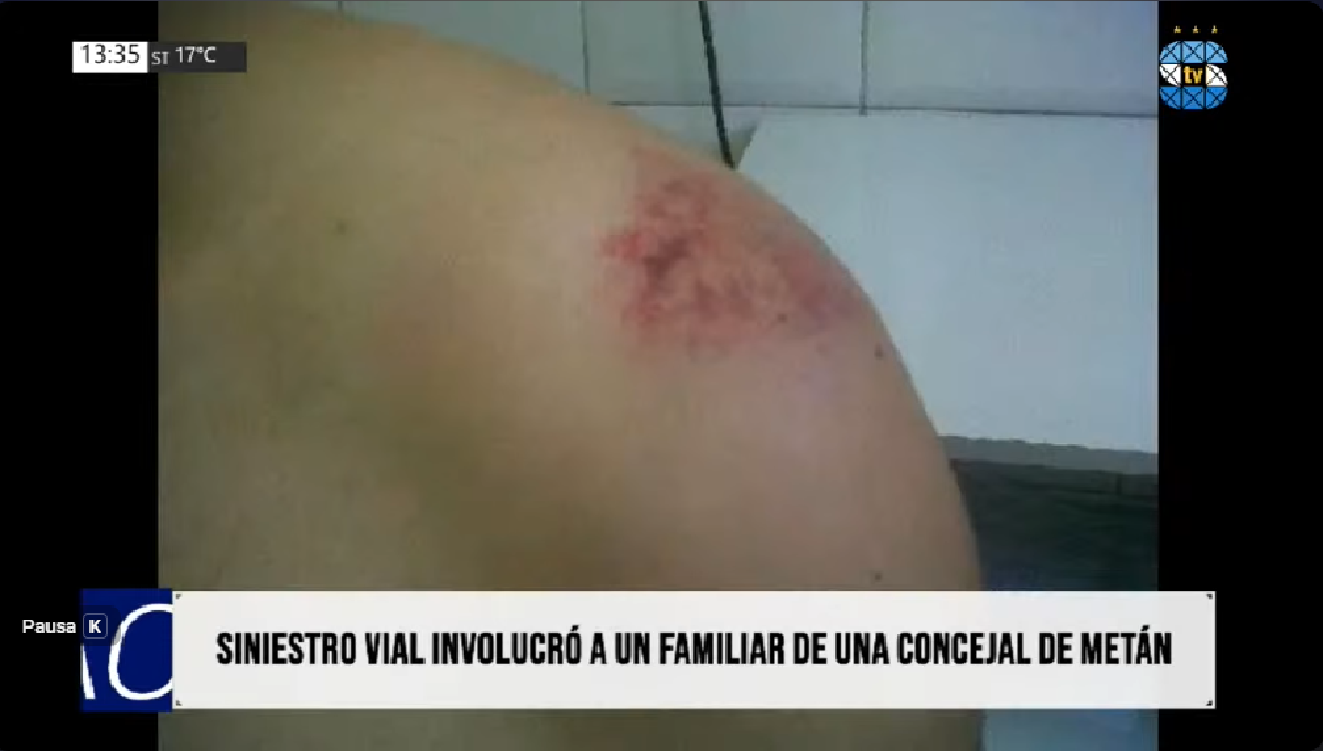 Siniestro Vial - hijo de una concejal.png Siniestro Vial - hijo de una concejal.png